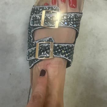 Bambi’den Aldığım Terlik Sağlığımı Tehlikeye Attı, İade Talebim Reddedildi!