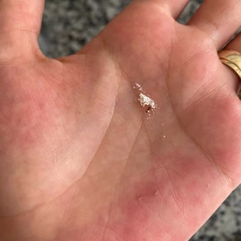 Bebelac 4 Devam Sütünde Karınca Çıkması Ve Sağlık Riski