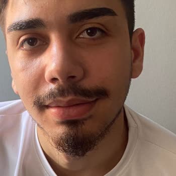 Oğlumun Kaşını Bozup Mağdur Ettiler Çözüm Bekliyorum