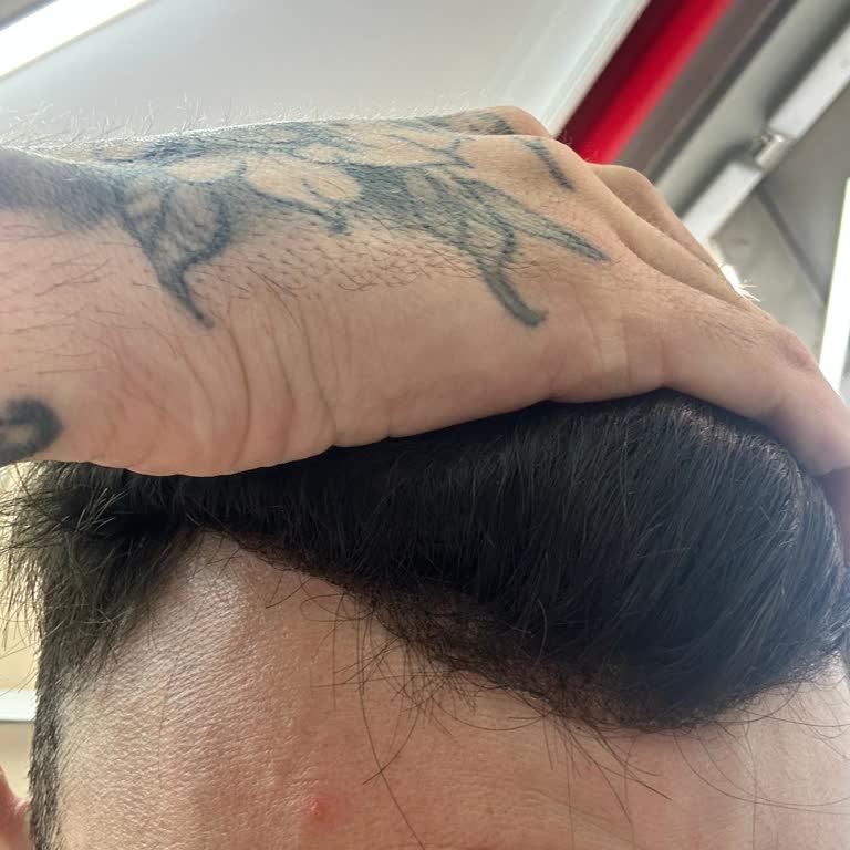 Gold Hair İstanbul'da Protez Saç Hizmetinde Kötü Deneyim Ve İlgisizlik