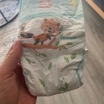 Prima Bebek Bezlerinde İdrar Göstergesi Eksikliği Şaşkınlık Yarattı