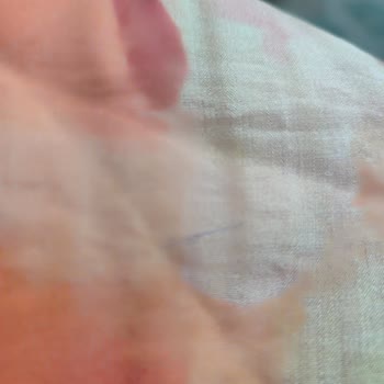 Aldığım Elbise Defolu Geldi, Değişim Talebim Reddedildi Ve Engellendim