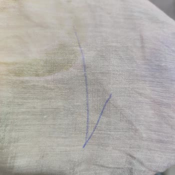 Aldığım Elbise Defolu Geldi, Değişim Talebim Reddedildi Ve Engellendim