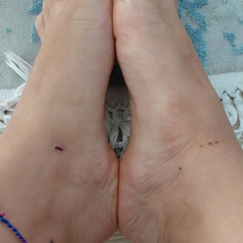 Terlik Kısa Sürede Yaralanmaya Sebep Oldu, İade Talebim Reddedildi