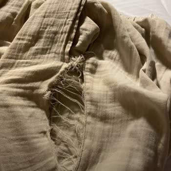 Zeliha Baysan Yırtılmalar Meydana Geldi