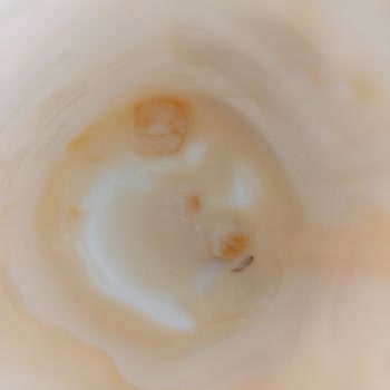 Activia Yoğurttan Kurt Çıkması Şoku