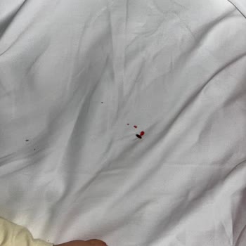 Otel Odalarında Ciddi Hijyen Sorunları Ve Mağduriyet