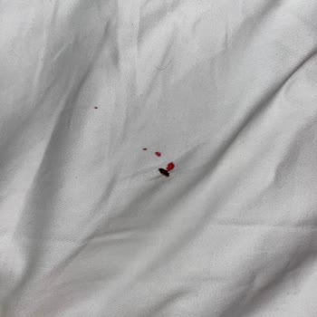 Otel Odalarında Ciddi Hijyen Sorunları Ve Mağduriyet