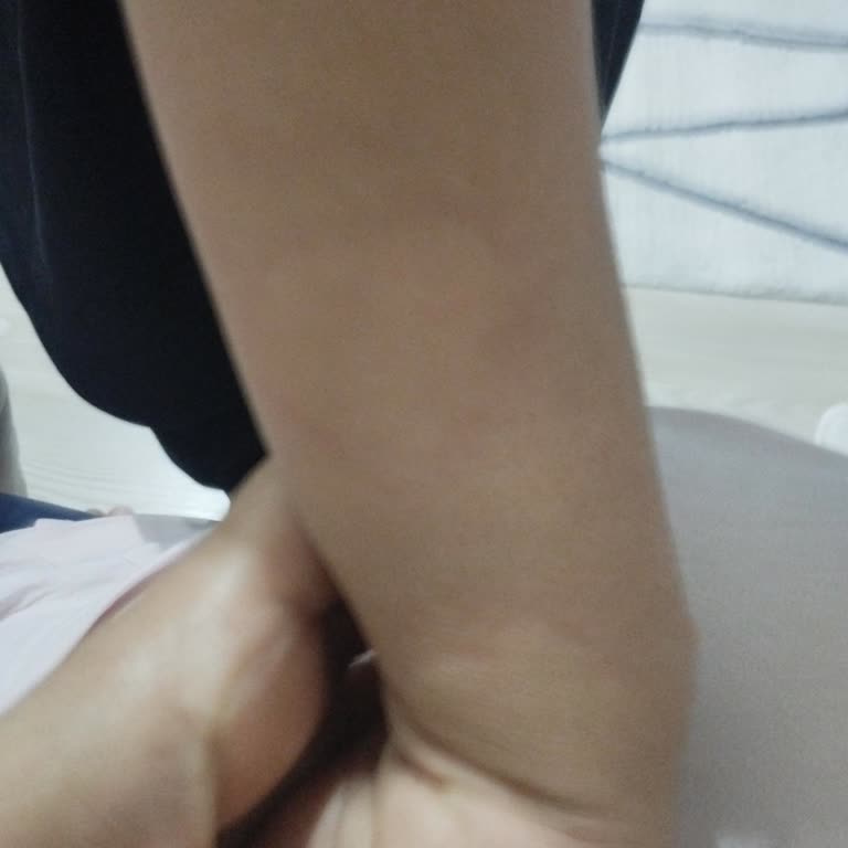 Krem Yan Etkileri Hakkında Bilgilendirme Ve Destek Eksikliği