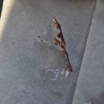 Protein Bar Ürününde Yabancı Madde Tespiti ve Güven Endişesi