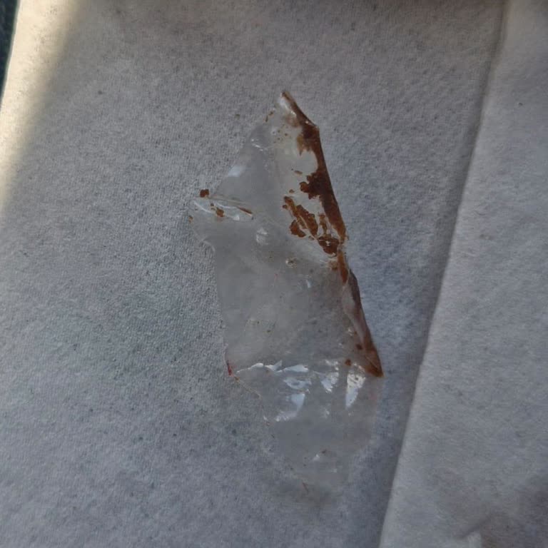 Protein Bar Ürününde Yabancı Madde Tespiti ve Güven Endişesi