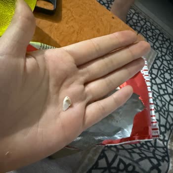 Tadım Çekirdek Paketinden Sert Cisim Çıktı, Dişim Zarar Gördü Ve İletişim Bilgisi Bulunmuyor