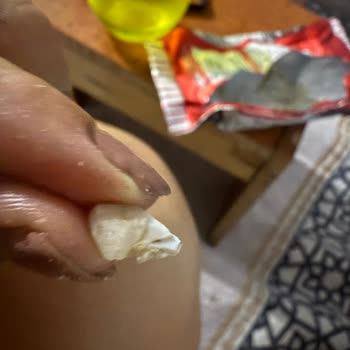 Tadım Çekirdek Paketinden Sert Cisim Çıktı, Dişim Zarar Gördü Ve İletişim Bilgisi Bulunmuyor