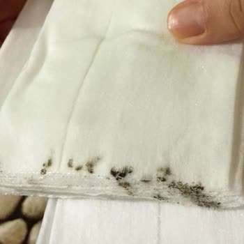 Sleepy Küflü Islak Mendil ve Yetersiz Müşteri Hizmeti: Bebeğimin Sağlığı Tehlikeye Girdi