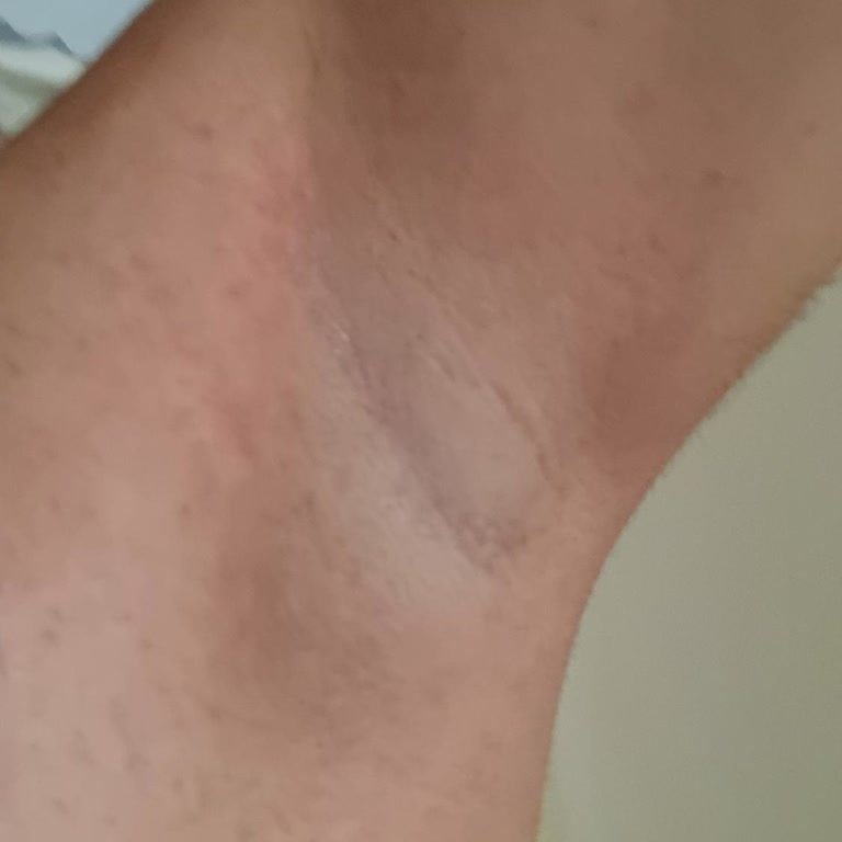 Nivea Black&White Deodorant Ciltte Tahriş Ve Kıyafette Leke Yaptı