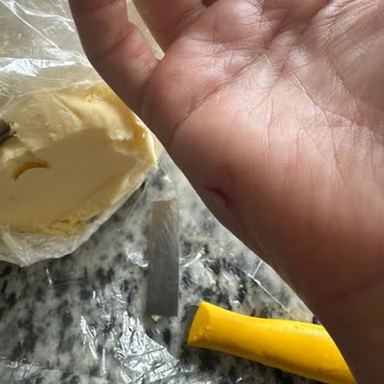 Zwilling Kırılan Bıçak Elimden Yaralanmama Ve Mağduriyete Yol Açtı, Çözüm Bekliyorum!