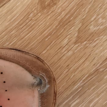 In Street Garanti Başvurum, "Tüketici Hatası" Denilerek Kabul Edilmedi!