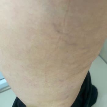 Yetkisiz İşlem, Sağlık Sorunları Ve Haksız Ücret Talebiyle Mağduriyet