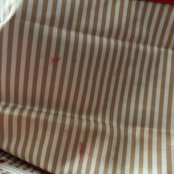 Çanta Bakımında Yetersiz Hizmet Ve Ücret İadesi Talebi