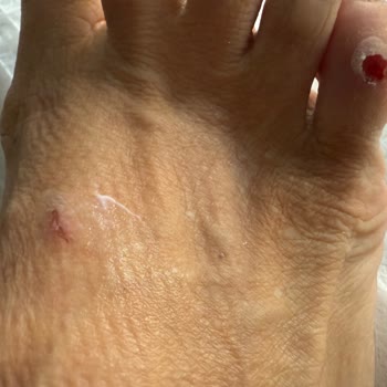 Kifidis'ten Aldığım Terlik Ayağımı Yaraladı, Değişim Ve İade Sürecinde Mağdur Edildim