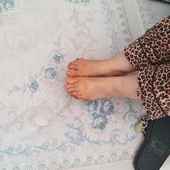 Mamma Mia Sandaletin Boyası Ayaklarımı Lekeliyor, Endişeliyim