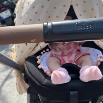 Chicco Bebek Arabasında Sap Kısmında Soyulma Sorunu Yaşadım