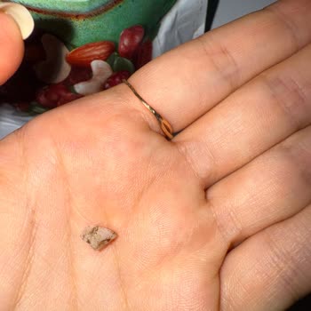 Çerez Paketinden Çıkan Taş Dişimi Kırıyordu, Müşteri Hizmetlerine Ulaşamıyorum