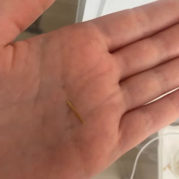 Çiğköfte Siparişimde Kürdan Parçası Çıktı, Sağlığım Tehlikeye Girdi