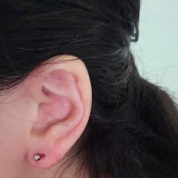 Van Dövme Piercing Fidan Demirel Kulak Delme Şikayeti