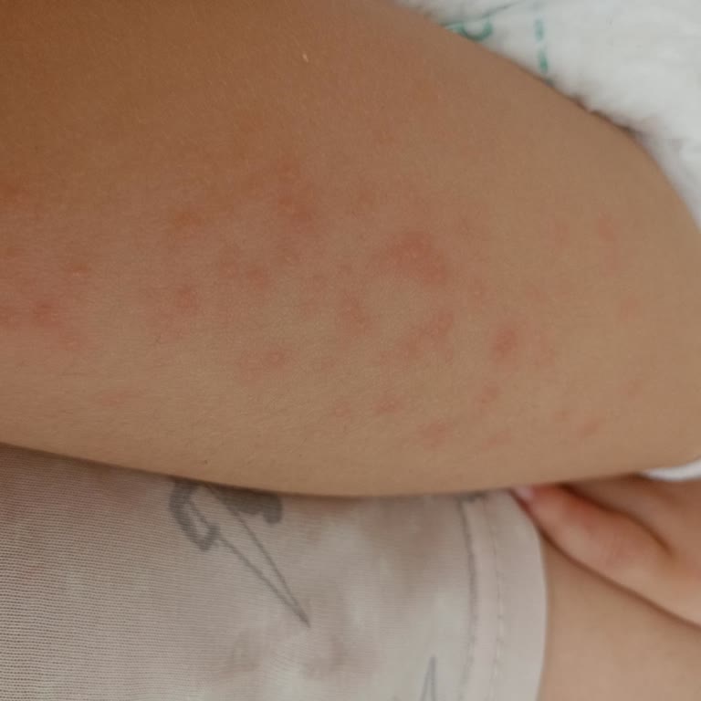 Jolly Park Oyun Alanında Yetersiz Hijyen Nedeniyle Çocuğum Hastalandı