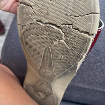 Ceyo Terliklerin Kısa Sürede Yırtılması Hayal Kırıklığı Yarattı