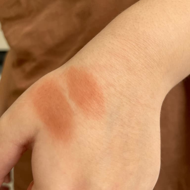 Orijinal Olmayan Ve Kırık Ürün Gönderimi Sonrası Satıcıdan Destek Alamama