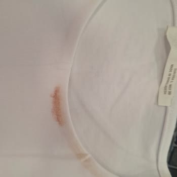 Lekeli Ürün Gönderimi Ve İade Süreci Mağduriyeti