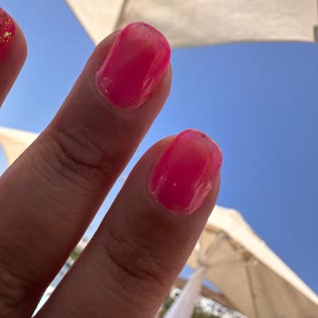 Hijyen Eksikliği Ve Kalitesiz İşlem Sonrası Mağduriyet