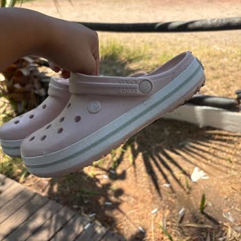 Crocs Ayakkabıda Ters Baskı Üretim Hatası Mağduriyeti