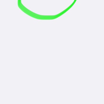 Suno Uygulamasında Abonelik İptali Sorunu Ve Haksız Ücret Kesintisi