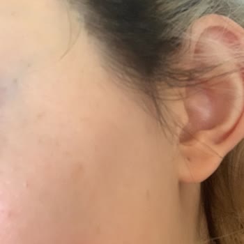 Glaw Studio Bağlıca/Etimesgut Şubesi Şikayeti