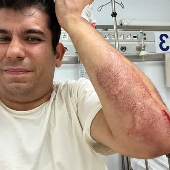 Yetkili Servis İhmalinden Ölümden Döndüm: Can Güvenliğim Tehlikeye Atıldı