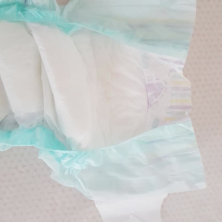 Bebek Bezinin Esnek Yan Bantları İşlevsiz Ve Pişik Yaptı