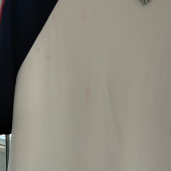 Yıkama Sonrası Renk Atan Modal Takımlar Ve Firma İlgisizliği