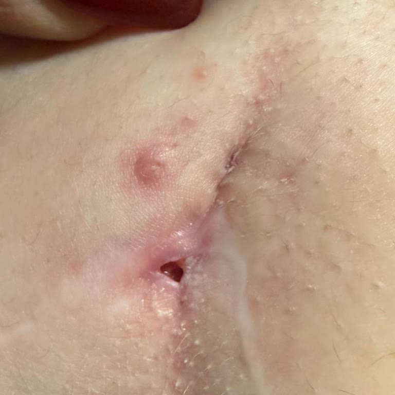 Op. Dr. Funda Aköz Saydam Ciddi Sağlık Sorunları Yaşıyorum