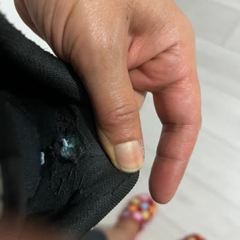 Kısa Sürede Hasar Gören Calvin Klein Sneaker İçin Değişim Veya İade Talebim Reddedildi