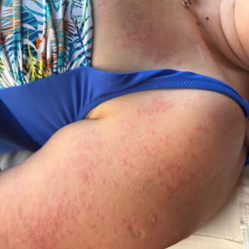 Cilt Sorunları Ve İletişim Eksikliğiyle Yaşanan Mağduriyet