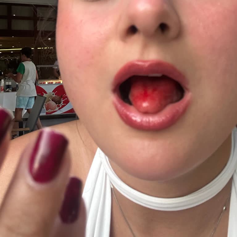 Hotel Samara'da Yaşadığım Mağduriyet