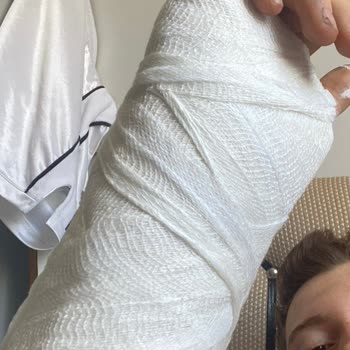 Yol Sulama Nedeniyle Kayıp Düşüp Bileğimin Kırılması Mağduriyetim