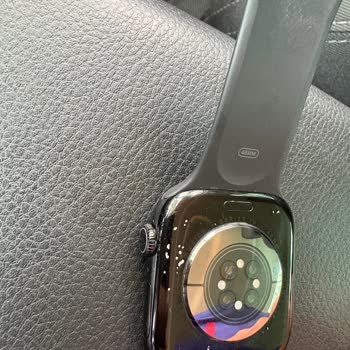 Apple Watch 10'da Garanti Kapsamında Boya Atması Sorunu