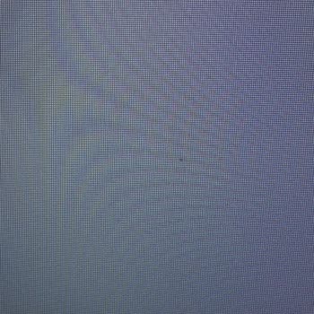 Servis Sonrası Devam Eden Ekran Sorunları Ve Saygısız Hizmet