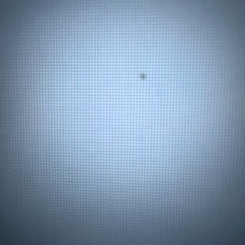 Servis Sonrası Devam Eden Ekran Sorunları Ve Saygısız Hizmet