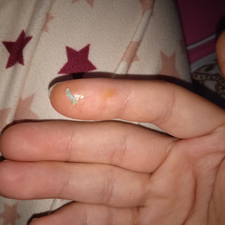 Kremanın İçinden Plastik Parça Çıktı: Şok Ve Hayal Kırıklığı!