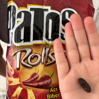 Patos Cips Paketinde Yabancı Cisim Ve Sağlık Riski